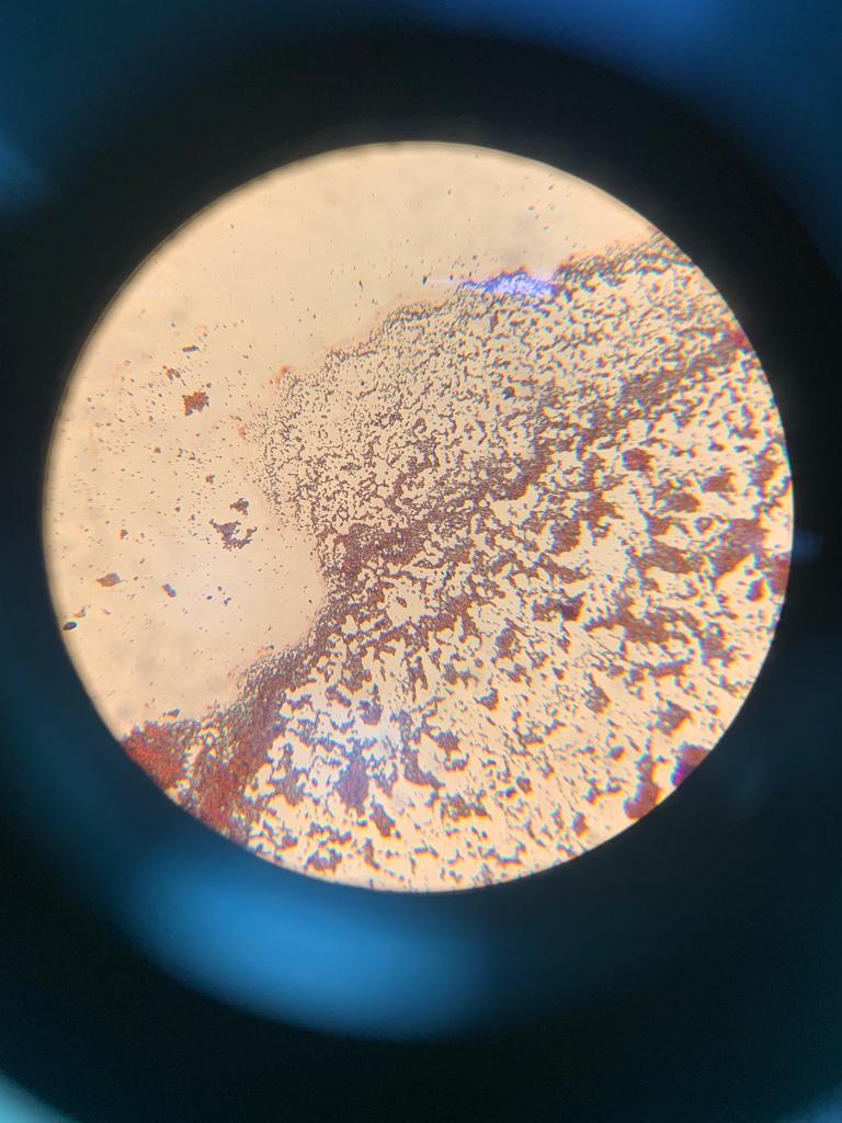 Gram staining result - Gram-negative (pink) bacteria