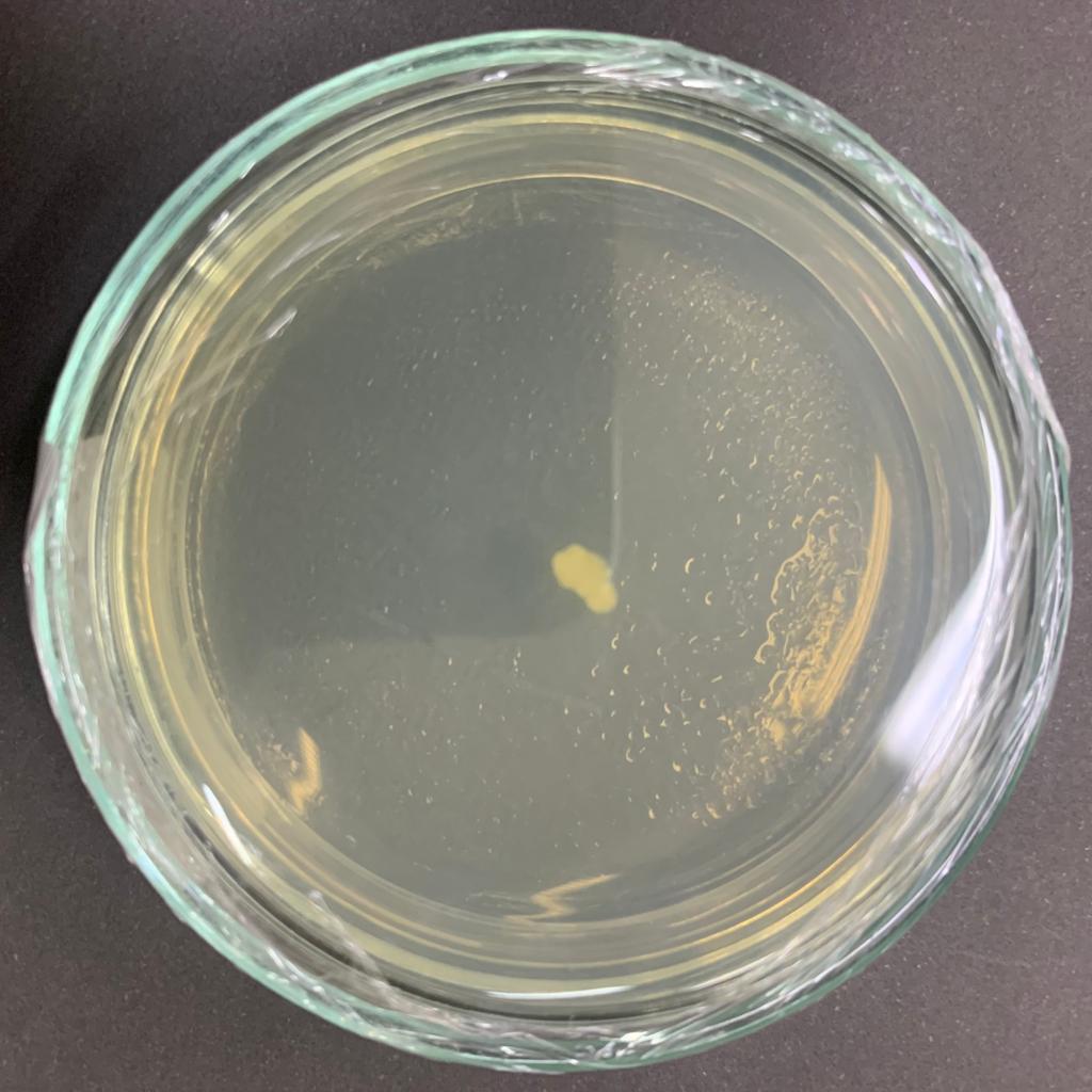 Bacterial isolation on selective media plate