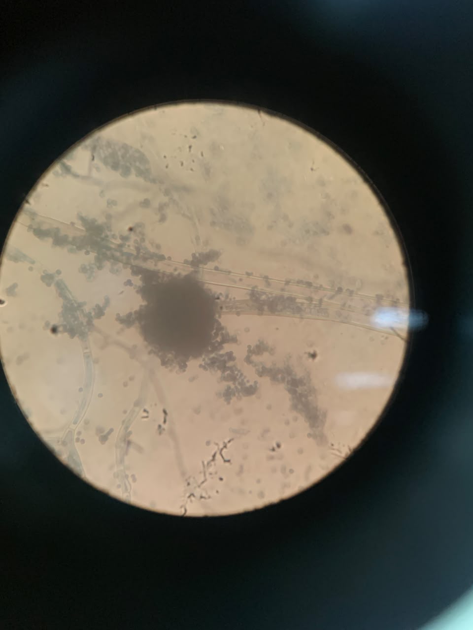 Microscopic spore observation under compound light microscope
